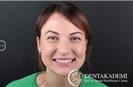 Zirconium Crowns - مركز دينت أكاديمي للرعاية الصحية للفم والأسنان