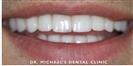 Couture Smile - Dr. Michael's Dental Clinics - سالة عيادة أسنان د. مايكل