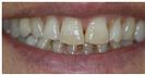 Couture Smile - Dr. Michael's Dental Clinics - سالة عيادة أسنان د. مايكل