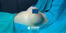 Breast Augmentation - مستشفى اداتيب  (ِADATIP)